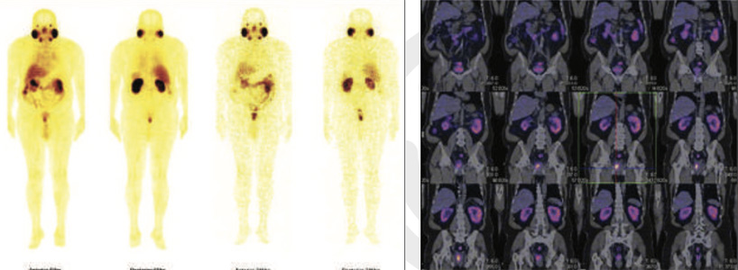Oncology