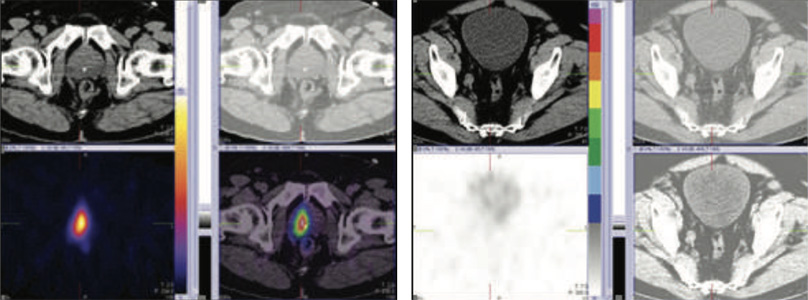Oncology