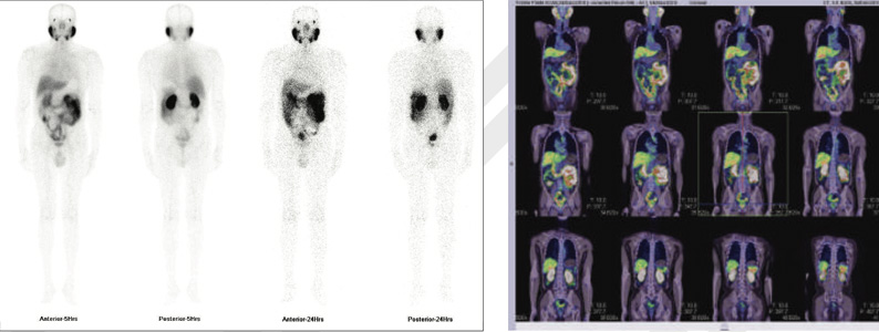 Oncology