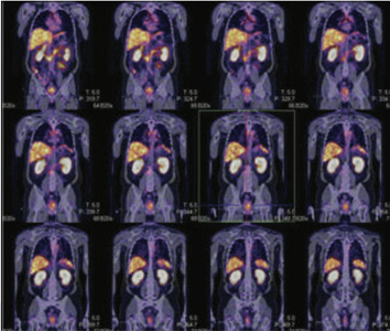 Oncology