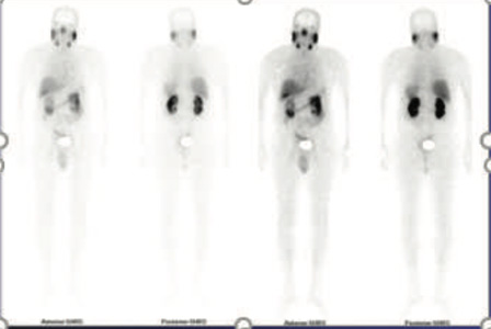 Oncology