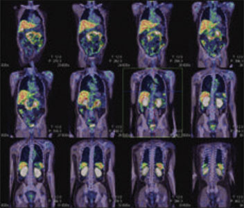 Oncology