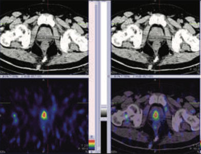 Oncology