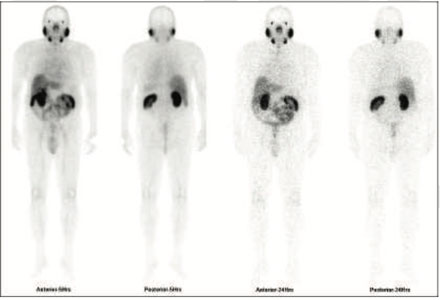 Oncology