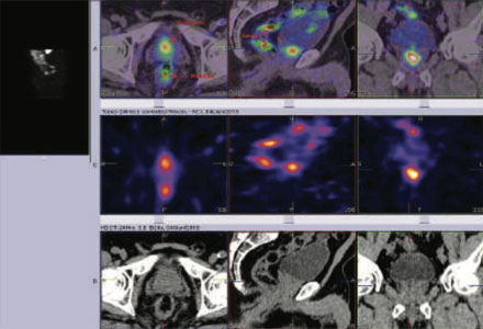 Oncology