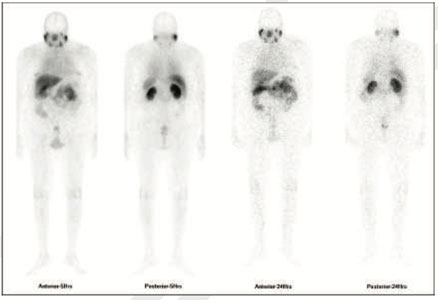 Oncology