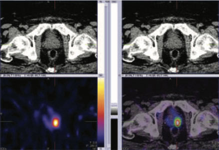 Oncology