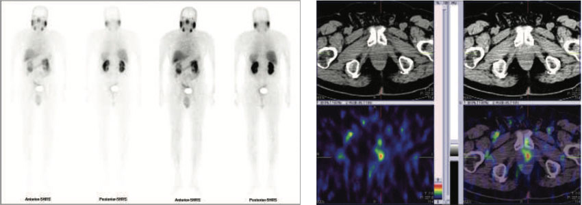 Oncology