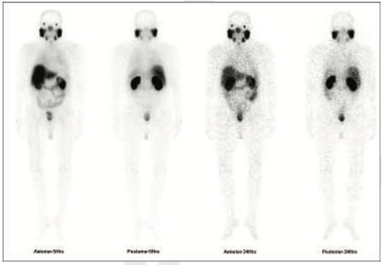 Oncology