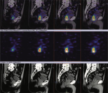 Oncology