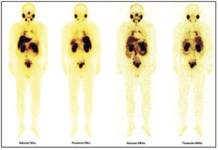 Oncology