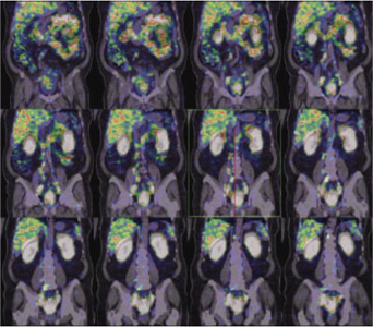 Oncology