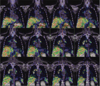 Oncology