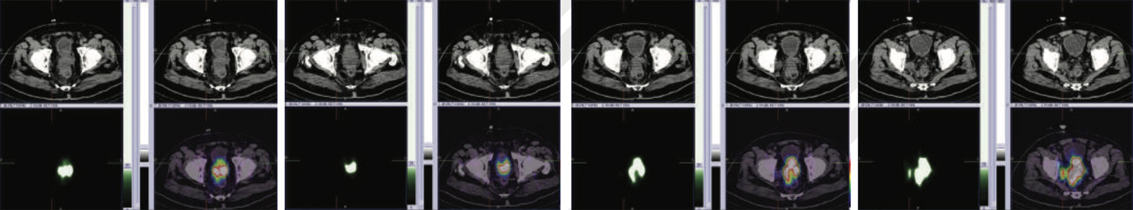 Oncology