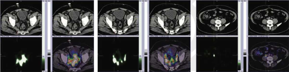 Oncology