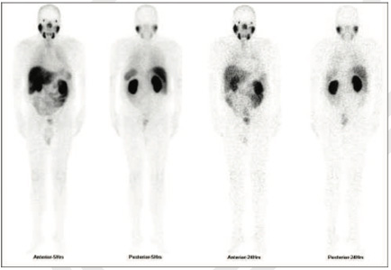 Oncology