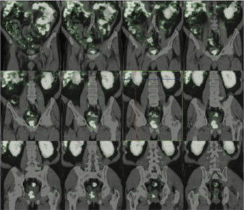 Oncology