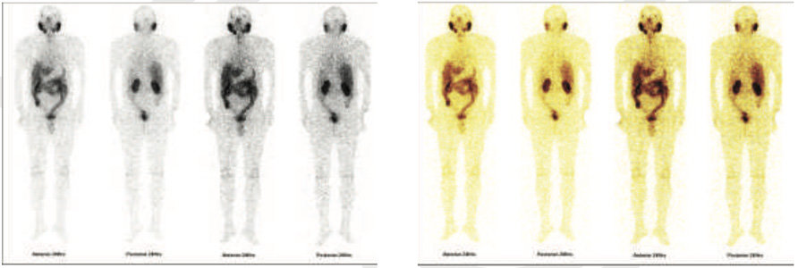 Oncology