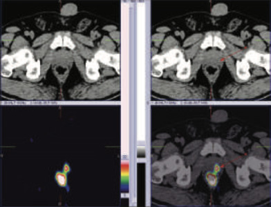 Oncology