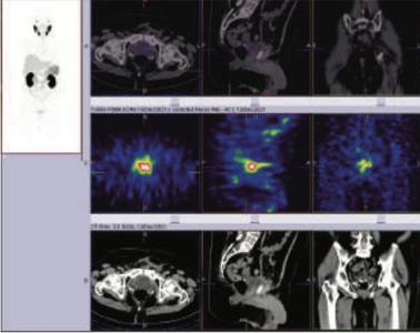 Oncology