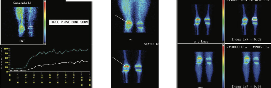 Orthopaedic