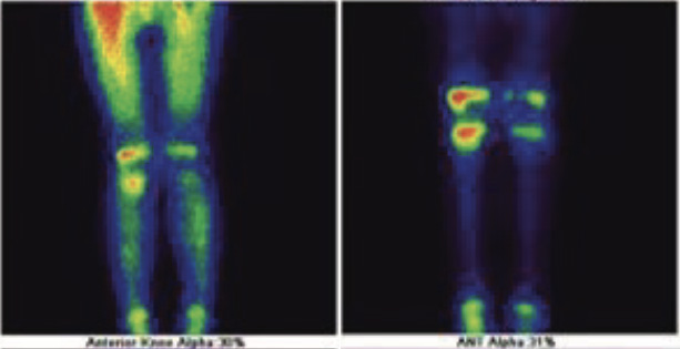 Orthopaedic