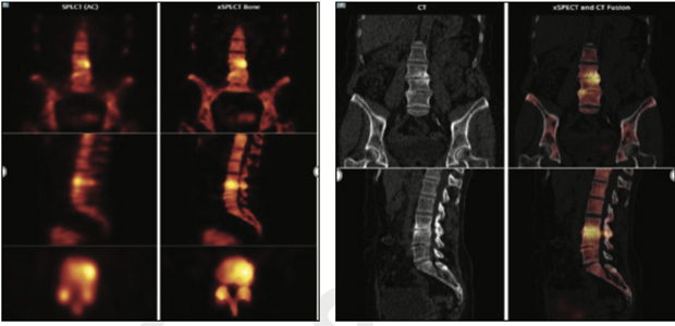 Orthopaedic