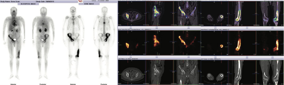 Orthopaedic