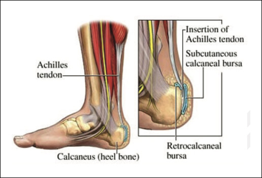 Orthopaedic