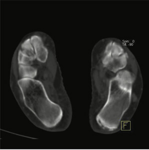 Orthopaedic