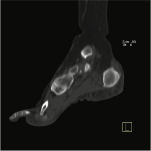 Orthopaedic