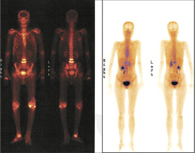 Orthopaedic