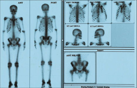 Orthopaedic