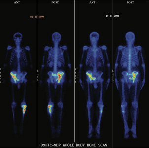 Orthopaedic