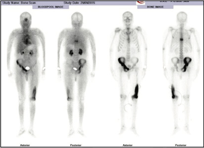 Orthopaedic