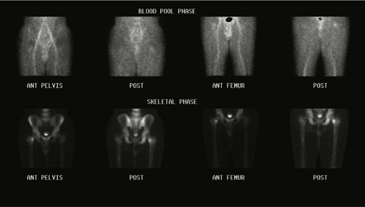 Orthopaedicd