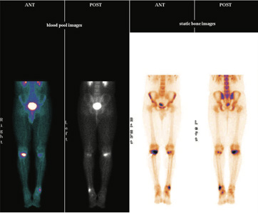 Orthopaedic