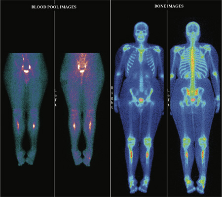 Orthopaedic