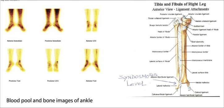 Orthopaedic