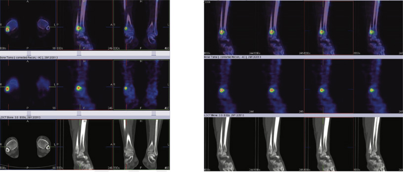 Orthopaedic