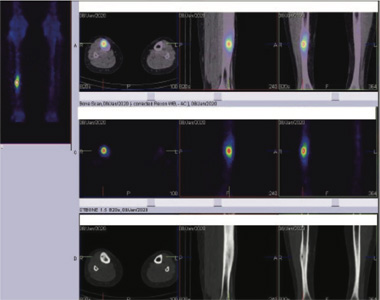 Orthopaedic