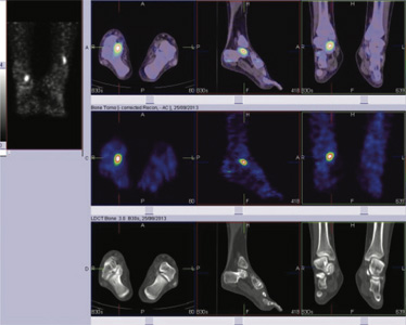 Orthopaedic