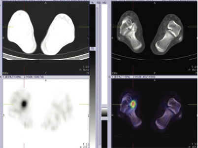 Orthopaedic