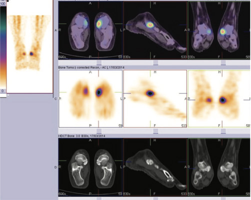 Orthopaedic