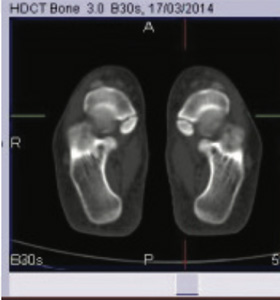 Orthopaedic