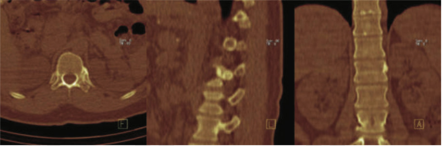 Orthopaedic
