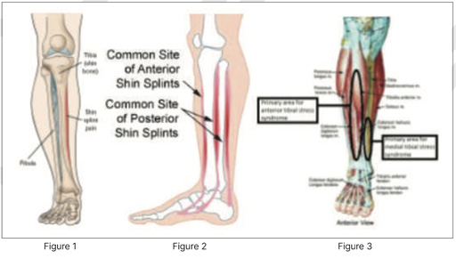 `orthopaedic