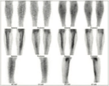 Orthopaedic