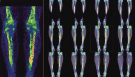 Orthopaedic