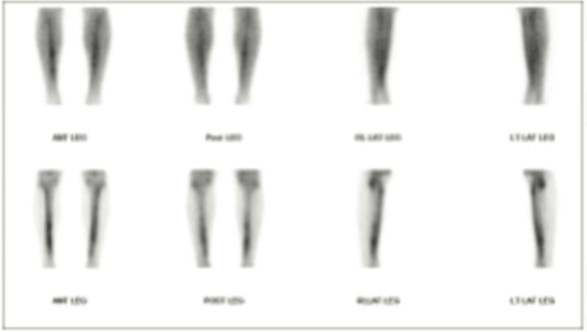 Orthopaedic
